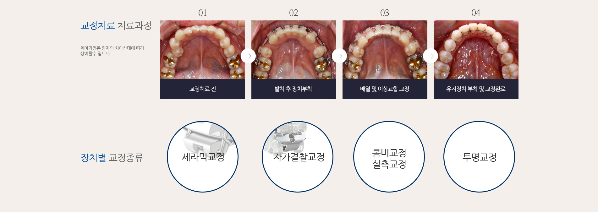 디지털 교정