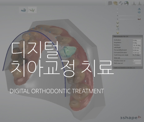 내게 맞는 치아교정