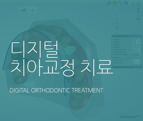 내게 맞는 치아교정 - 노형큐치과 