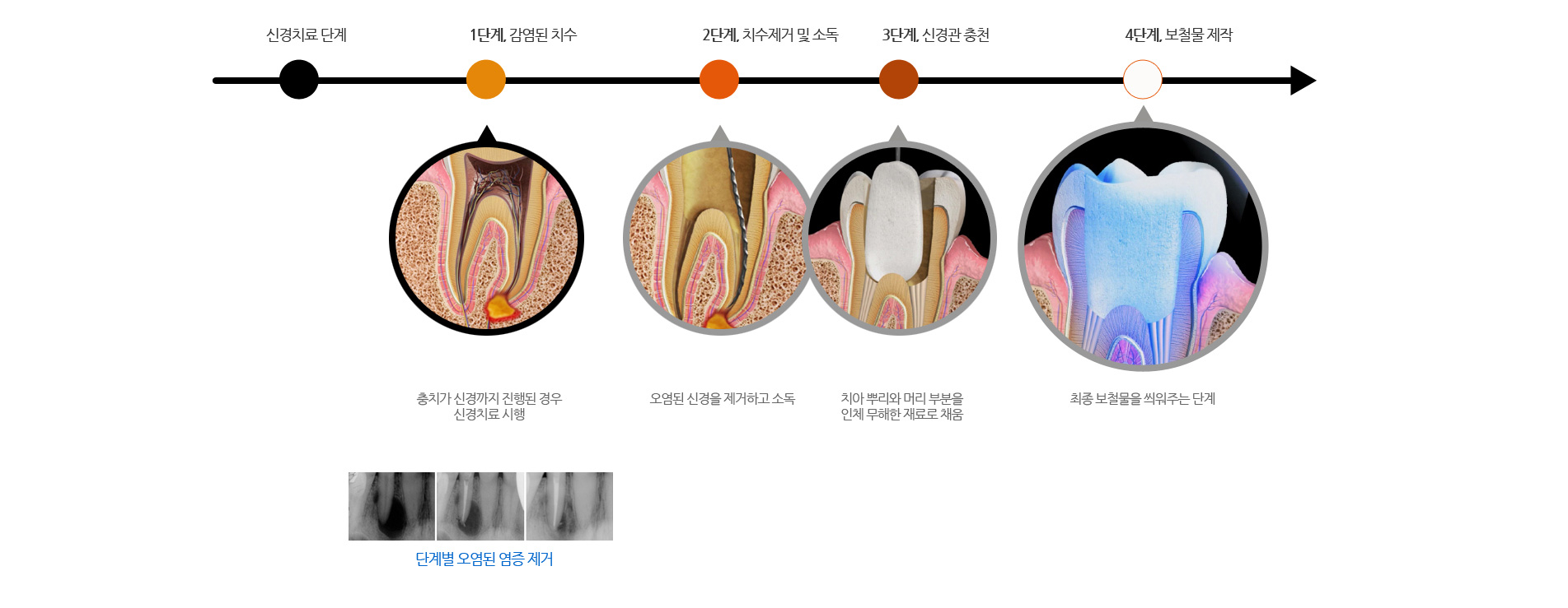 노형큐치과