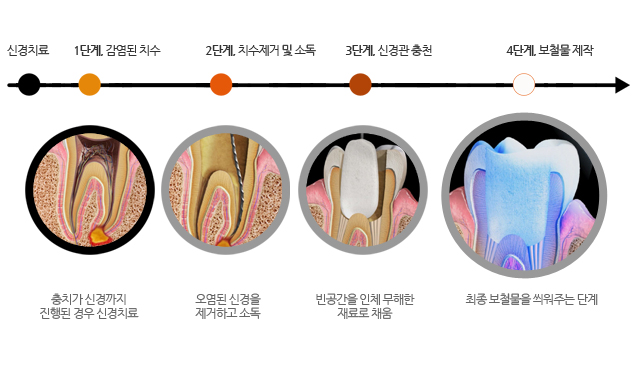 노형큐치과