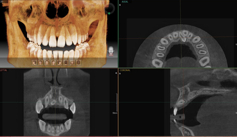 3D CT/파노라마 촬영을 통한 정확한 진단 